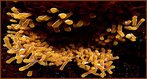 معرفی آزمایش سریع برای تشخیص بیماری سل (TB)